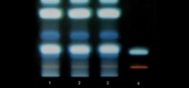 Chromatographie sur couche mince Chromatographie sur couche mince